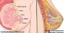 ۸ علت درد نوک سینه زنان