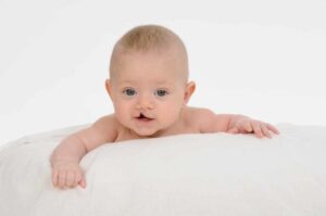 عوامل بروز لب شکری در نوزادان چیست و چه درمان‌هایی دارد؟
