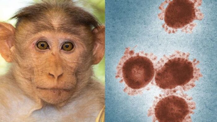 آبله میمونی یا ویروس میمون B